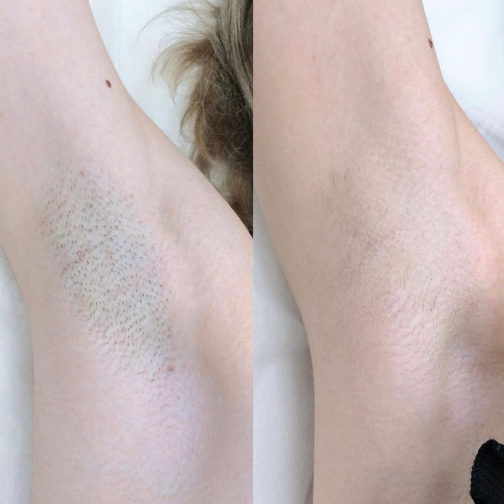 صورة —نور، الدمام