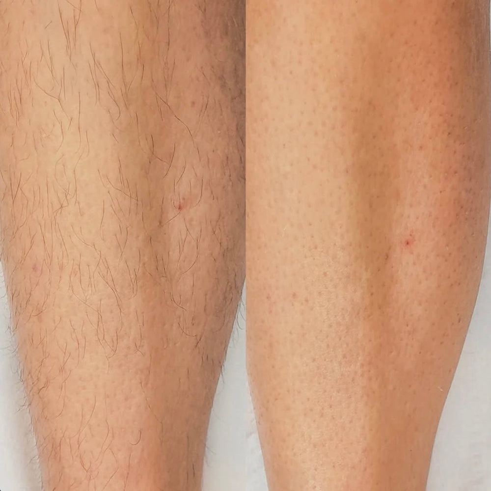 صورة — ريم، مكه