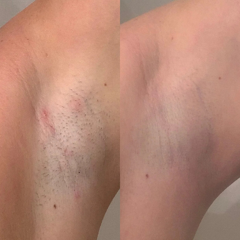 صورة — ياسمين، جدة